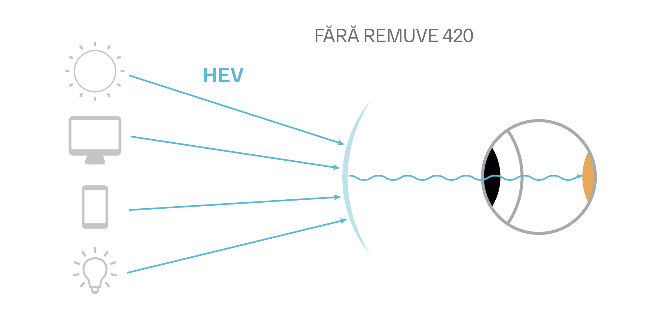 remuve